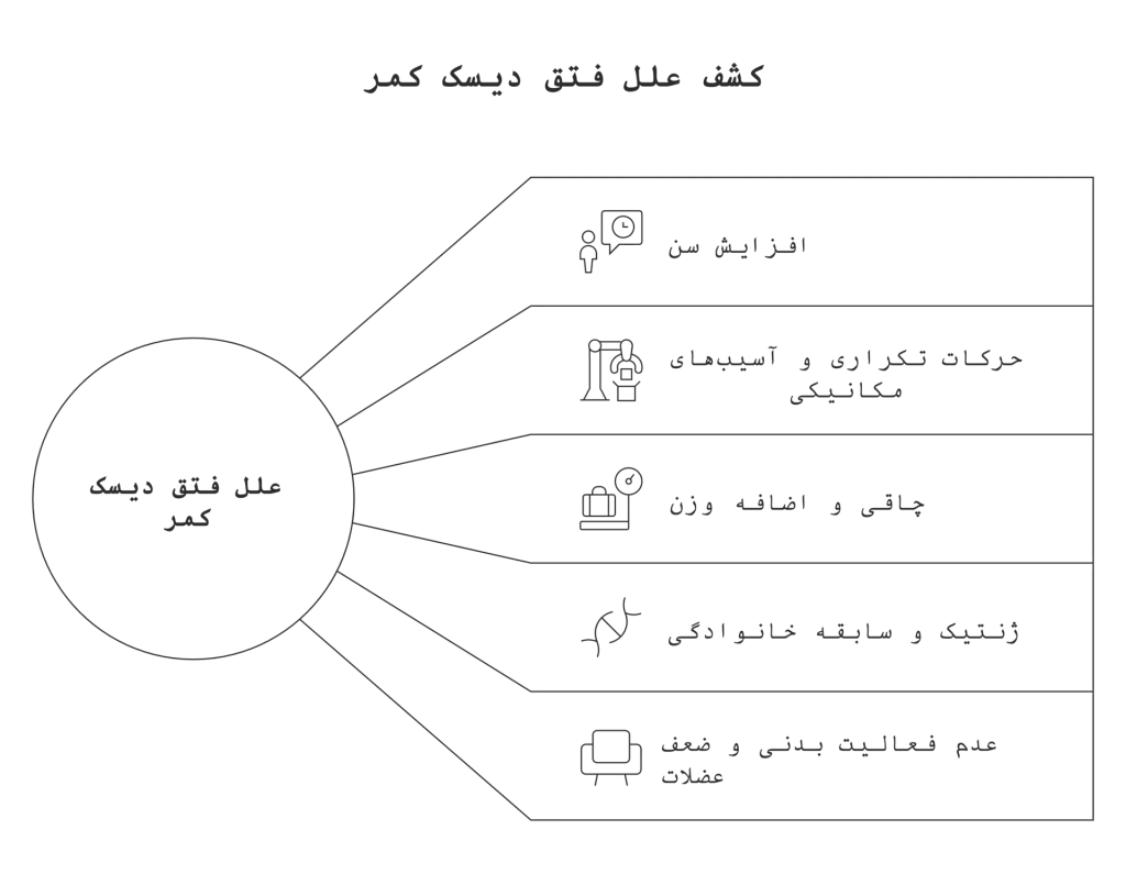 علل رایج فتق دیسک کمر